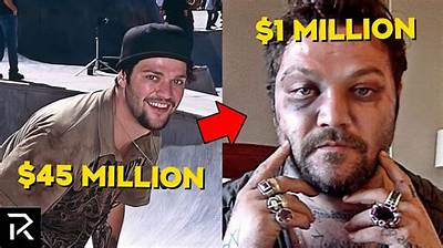 Bam Margera Net Worth, Age, Height, Bio, Birthday, Wiki!