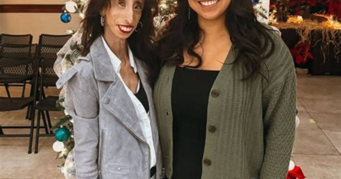 Lizzie Velasquez Net Worth, Age, Height, Bio, Birthday, Wiki!