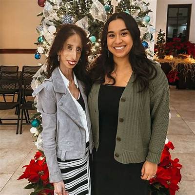 Lizzie Velasquez Net Worth, Age, Height, Bio, Birthday, Wiki!