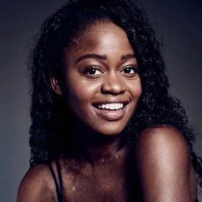Michaela Deprince Net Worth 2024, Age, Height, Bio, Birthday, Wiki!